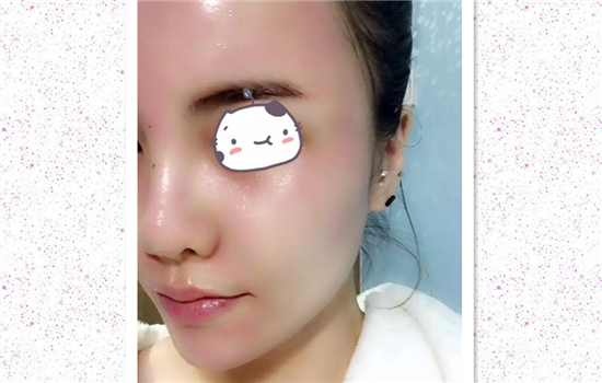 菲洛嘉水光针副作用 这5大副作用你知道几个呢