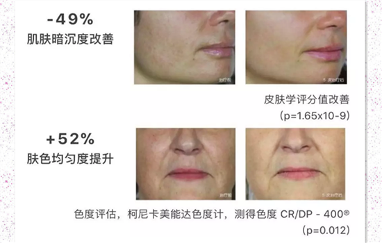 法国水光针菲洛嘉好吗 53种营养8大功效拯救你的肌肤