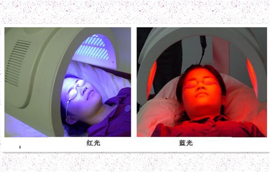 激光祛痘几天可以洗脸 不同激光治疗洗脸时间有差异