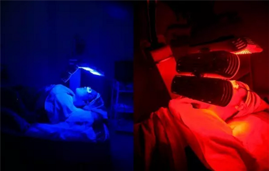 激光祛痘的原理是什么 医美无创治痘的秘密你竟然不知道