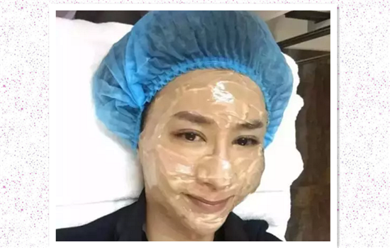 激光去痘印经历 来自医美启蒙博主的分享