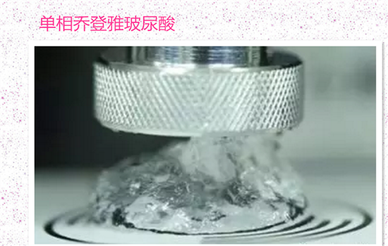 玻尿酸填充法令纹会移位吗 这些玻尿酸才不容易发生位移