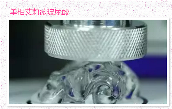 玻尿酸填充法令纹会移位吗 这些玻尿酸才不容易发生位移