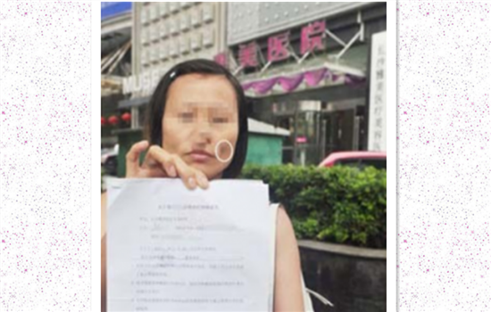 脂肪填充法令纹毁容 看完你还敢轻易填充法令纹吗