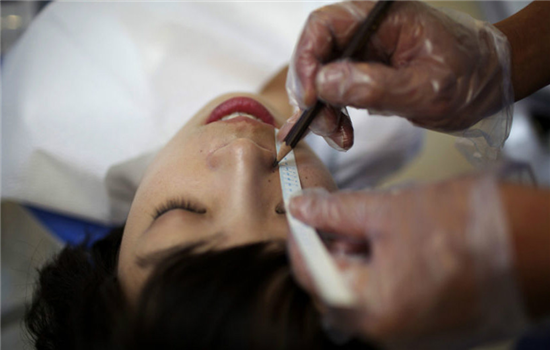 脂肪填充法令纹毁容 看完你还敢轻易填充法令纹吗