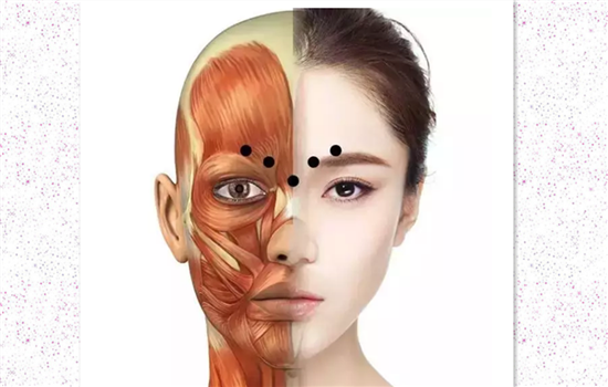 川字纹打肉毒素可以吗 眉间纹打肉毒的秘密你一定要知道