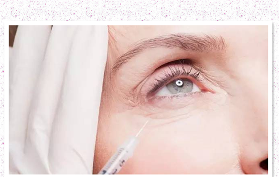 鱼尾纹除皱方法 守护心灵之美的方法你都知道吗