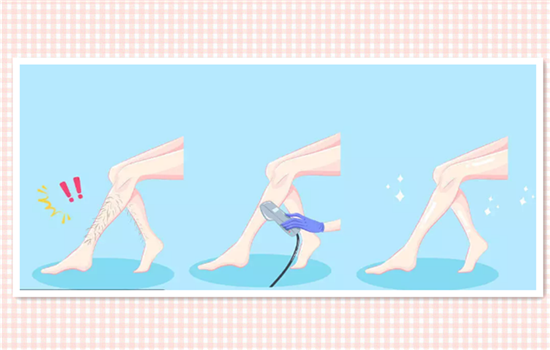 脱毛仪器怎么操作 新手一看就会的脱毛仪用法教程