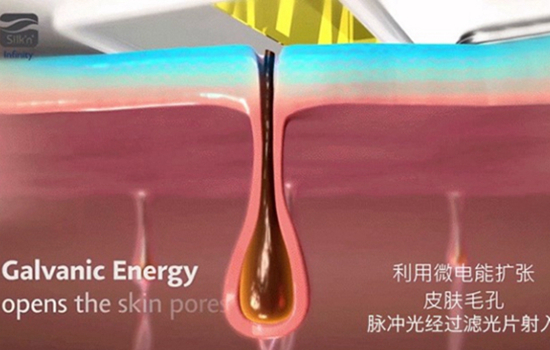 silkn脱毛仪有副作用吗 使用不当要小心这3大副作用