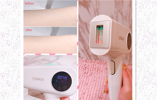ulike脱毛仪有用吗 谁说便宜脱毛仪没有效果
