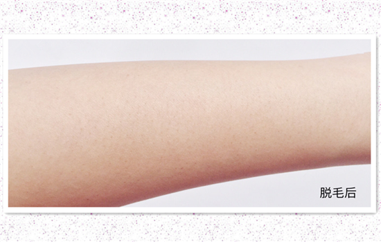 雅萌脱毛仪闪灯次数是多少 深扒yaman脱毛仪参数