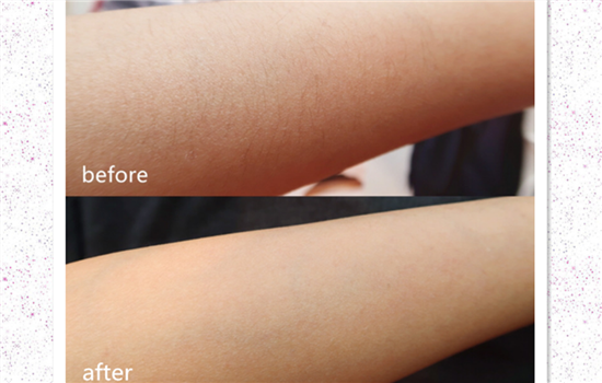 ulike脱毛仪怎么样 扒一扒韩国最出名的冰感光子脱毛仪