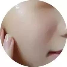 水光针怎样注射 你打的水光针为什么没有用