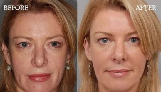 用醋减肥的方法 原来用醋就能减肥