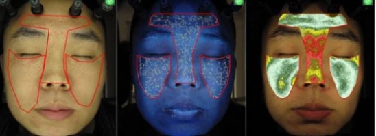 医美是什么意思 适合学生的医美项目