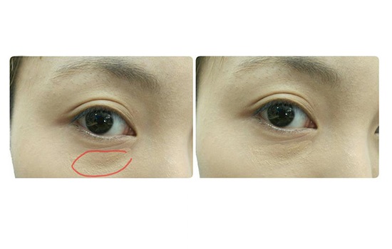 遮瑕膏怎么遮眼袋 遮瑕膏如何遮眼袋