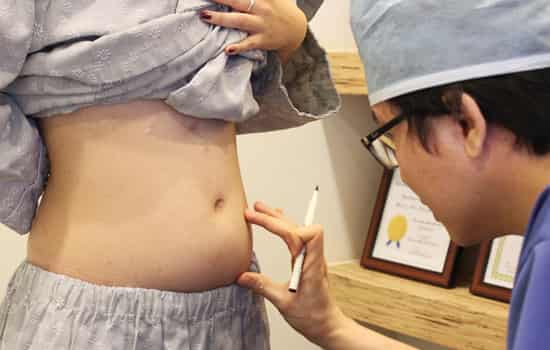 冷冻溶脂多少钱 冷冻溶脂价格